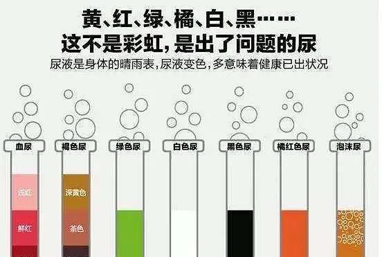 尿液变绿色的原因及其健康含义（探究尿液发绿的可能原因，了解身体健康情况）