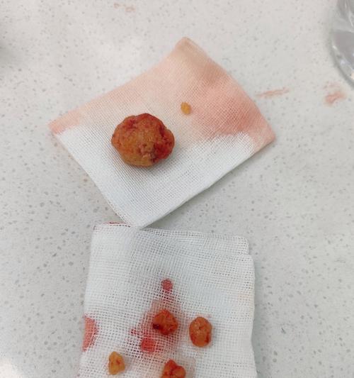 犬结石的症状及预防措施（探究犬结石的常见症状，为您的爱宠提供预防保健建议）