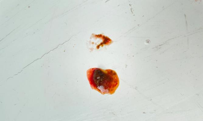 成年狗拉血的原因及处理方法（探究成年狗拉血的可能原因及有效的处理方法）