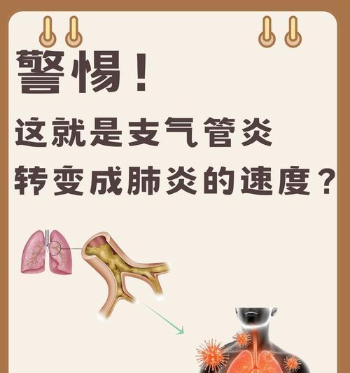 文章详情图片